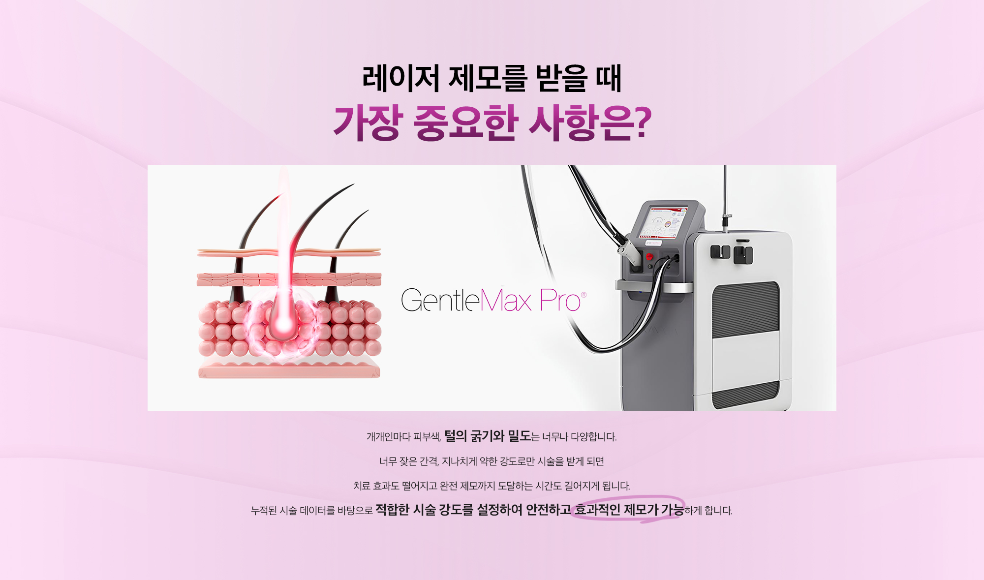 젠틀맥스프로 제모