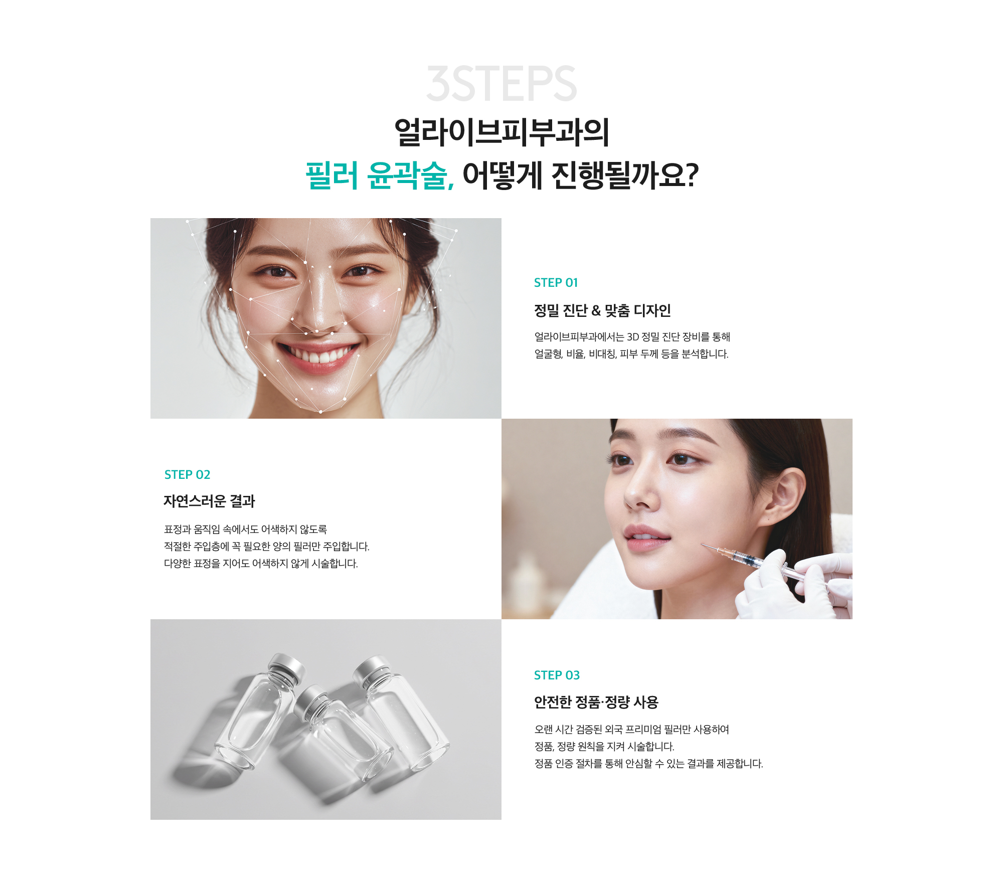 필러 윤곽술
