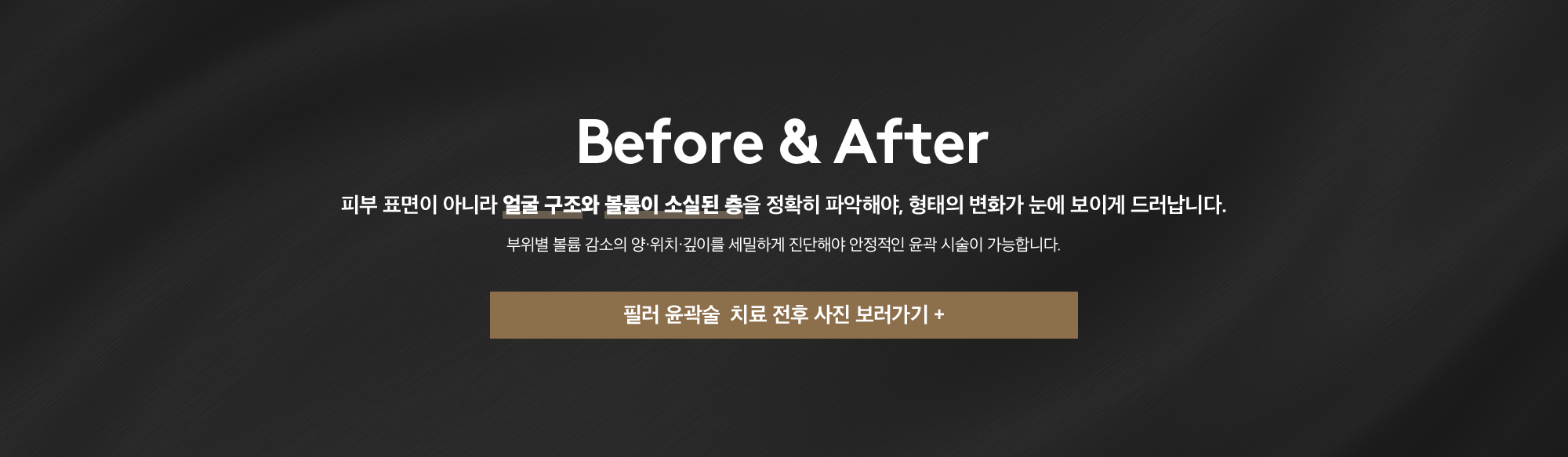 필러 윤곽술