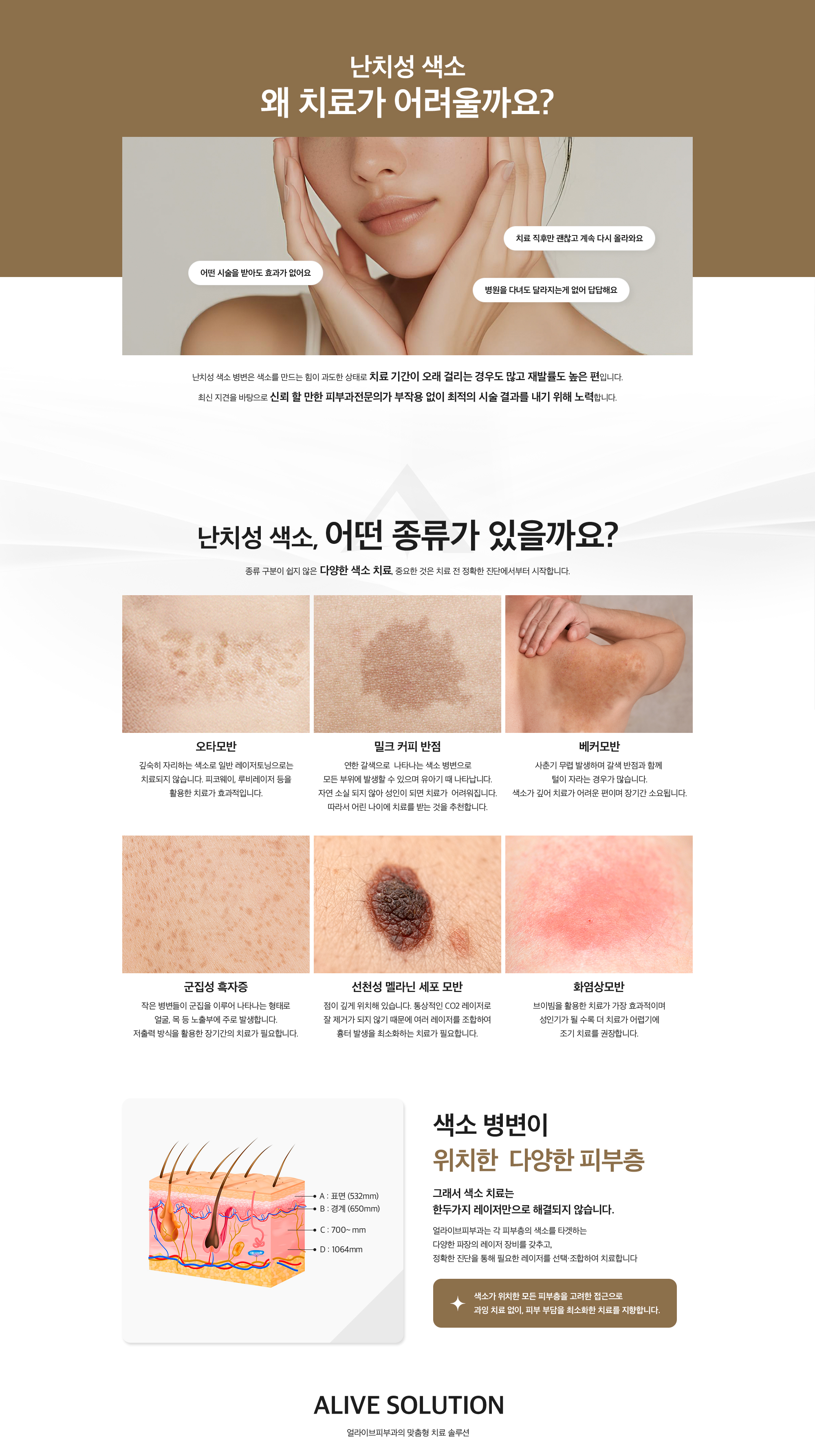 난치성 색소 치료