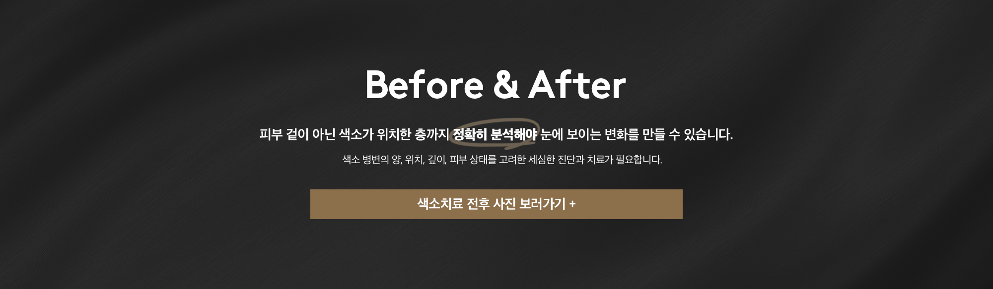 기미, 잡티, 흑자