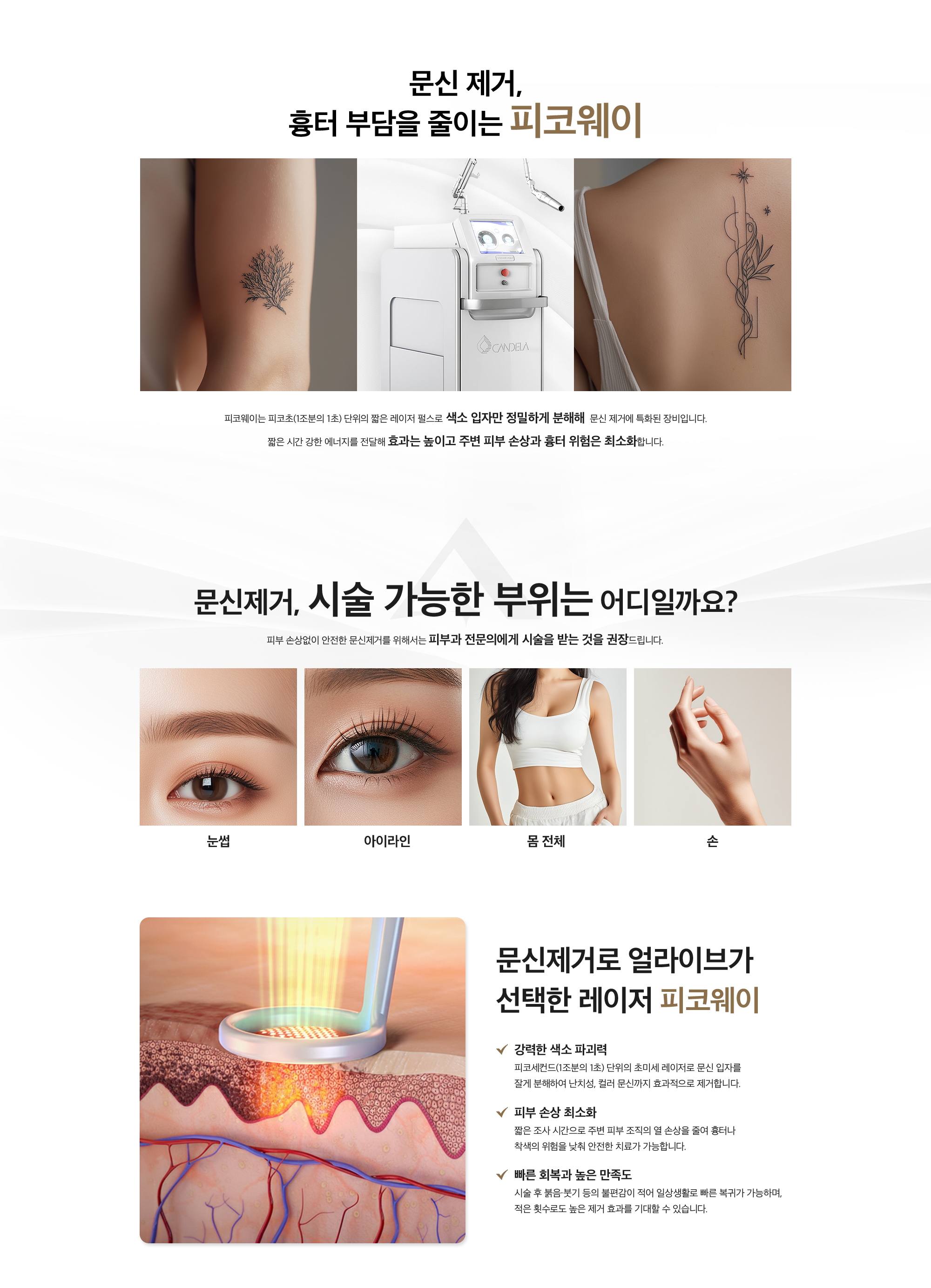 문신제거
