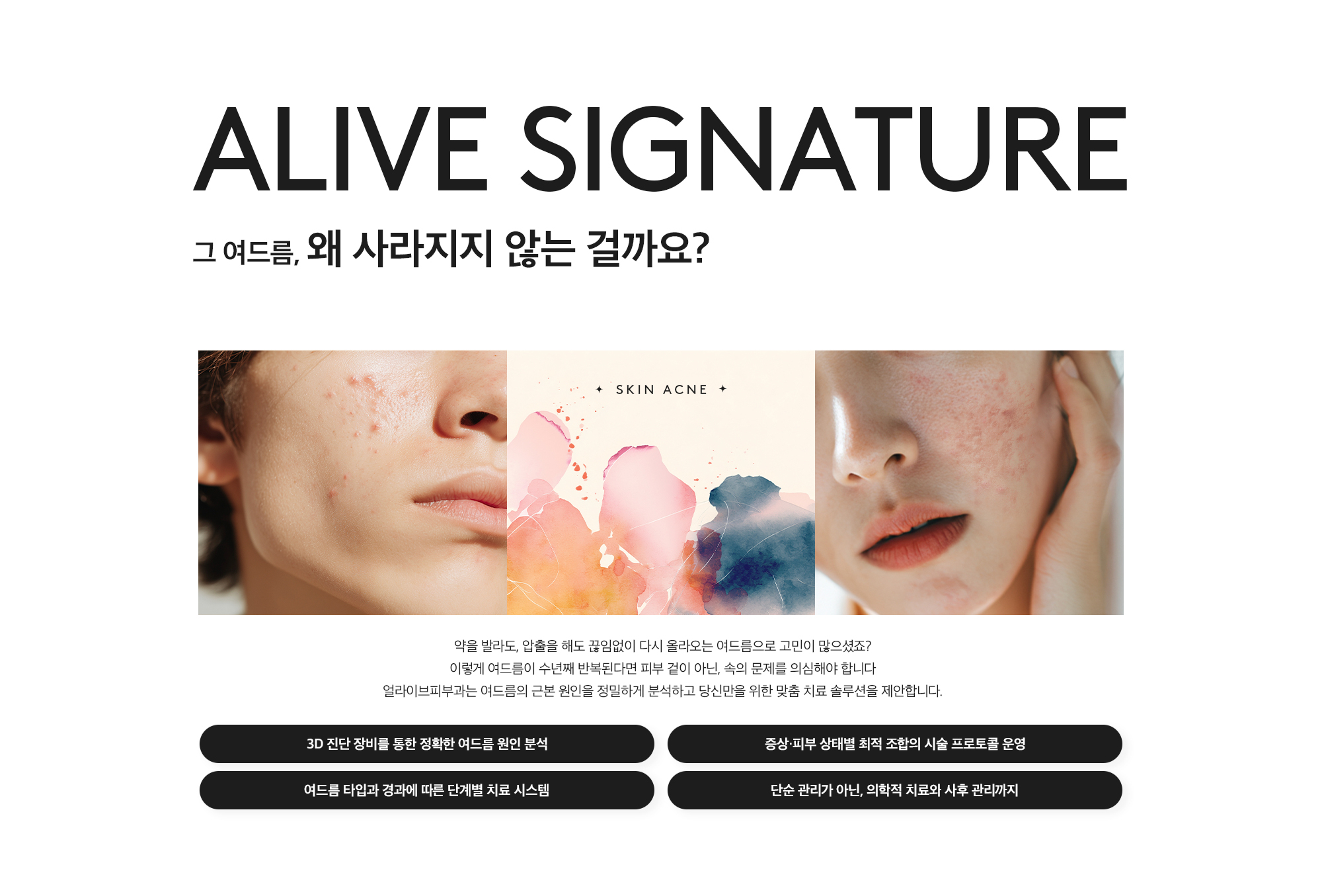 난치성 여드름 치료