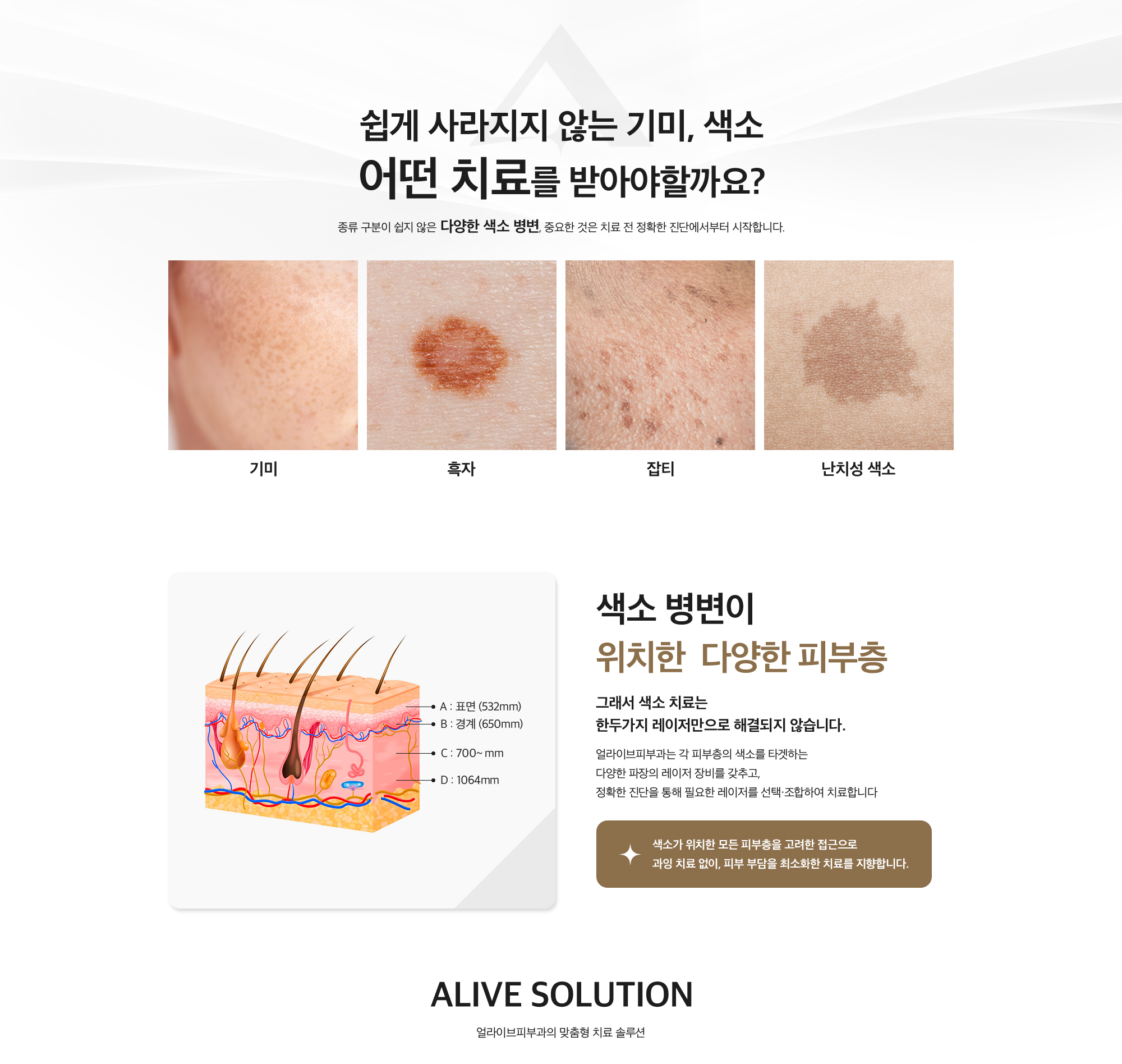 색소 치료