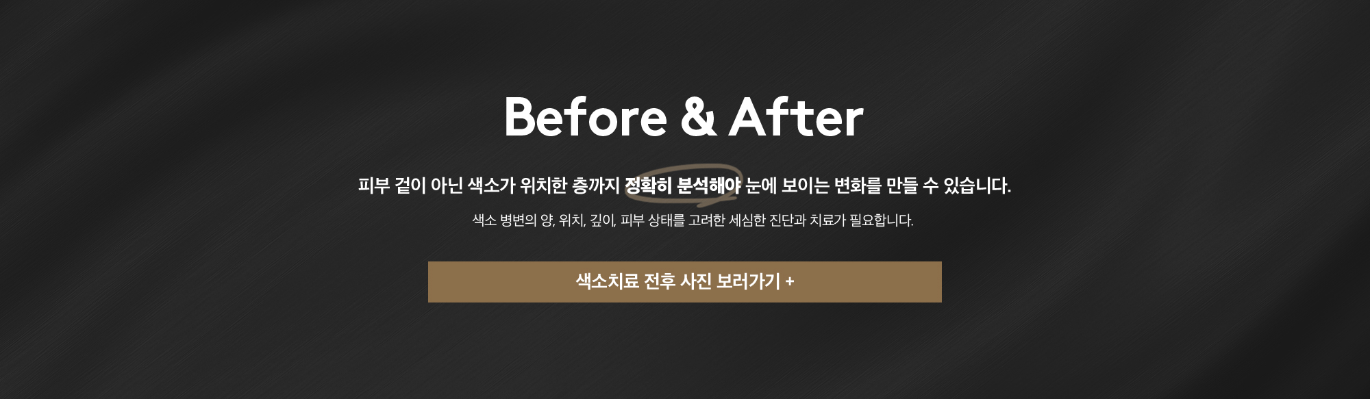색소 치료