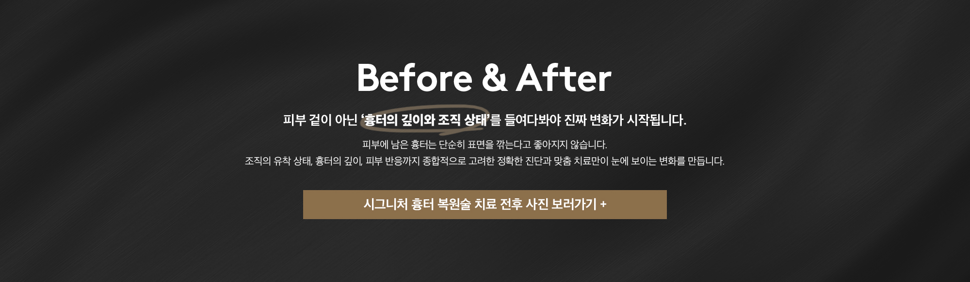 시그니처 흉터 복원술
