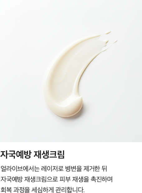 [자국예방 재생크림] 얼라이브에서는 레이저로 병변을 제거한 뒤 자국예방 재생크림으로 피부 재생을 촉진하며 회복 과정을 세심하게 관리합니다.