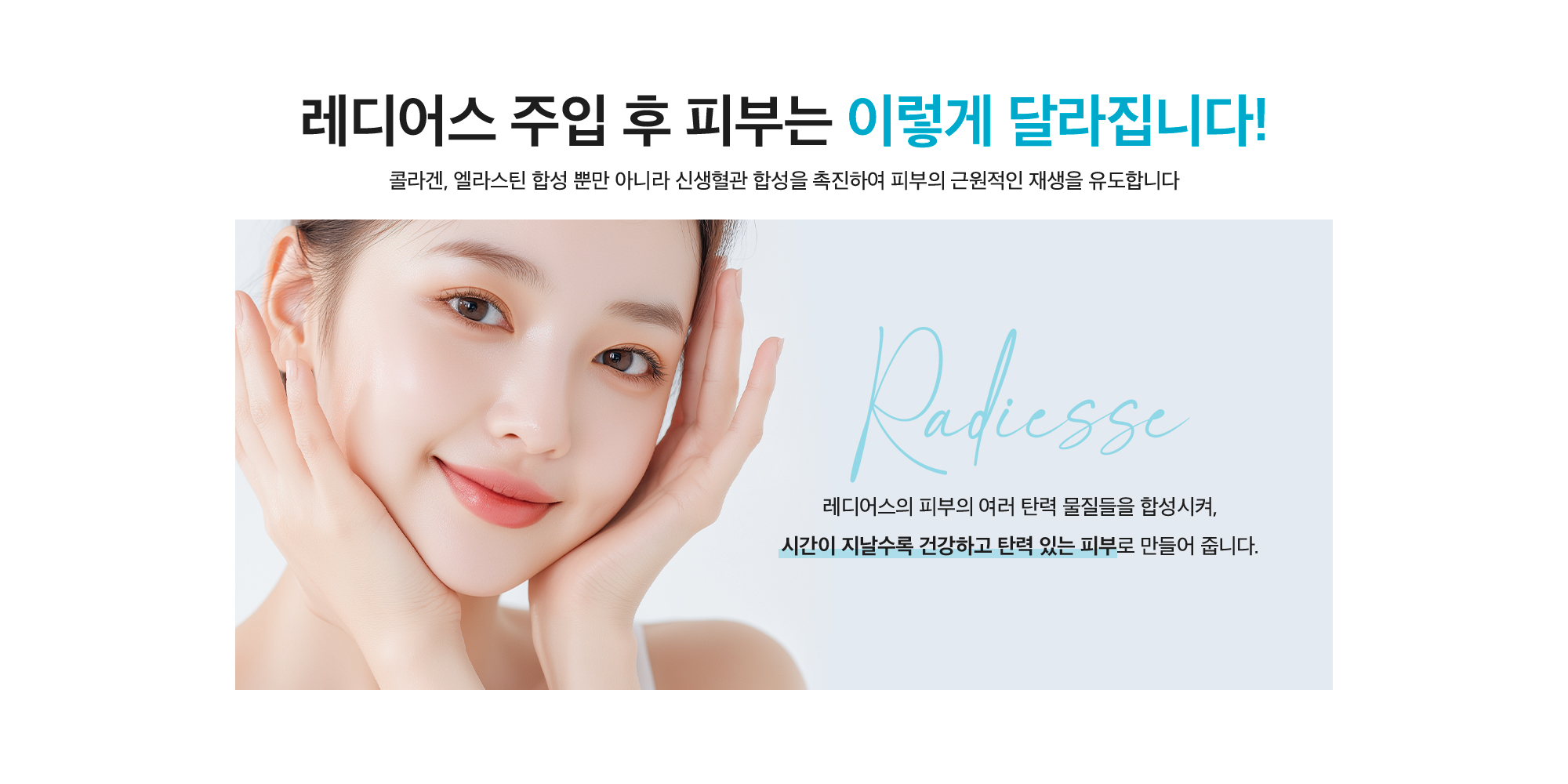 레디어스